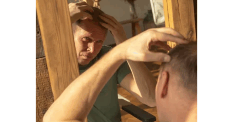 Best Hair Loss Treatment For Men: A Complete Guide to Restoring Confidence